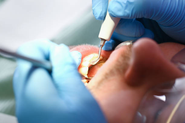Best Dental Abscess Treatment in Dexter, GA